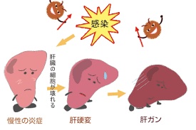 画像２